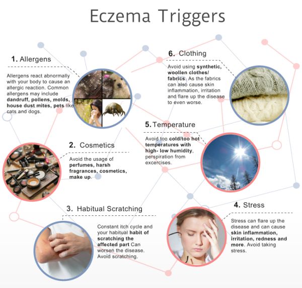 eczema triggers