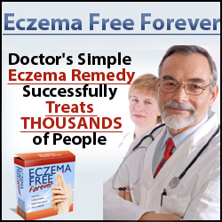 how to treat eczema free you