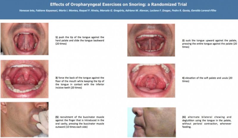 stop snoring exercises