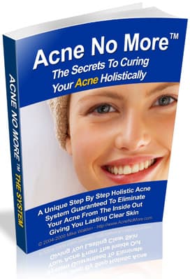 Acne No More